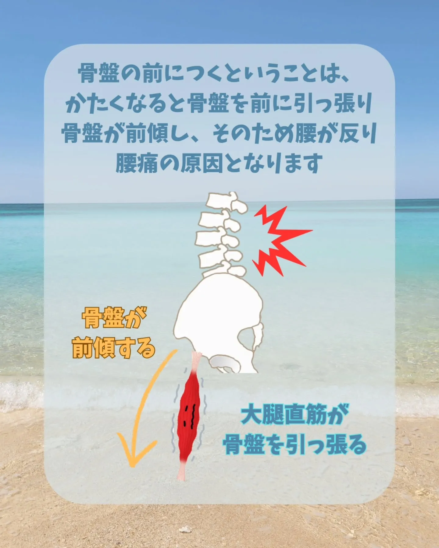 【腰痛の人にありがちな身体のかたさ-前腿-】